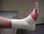 Cheerleading Injury